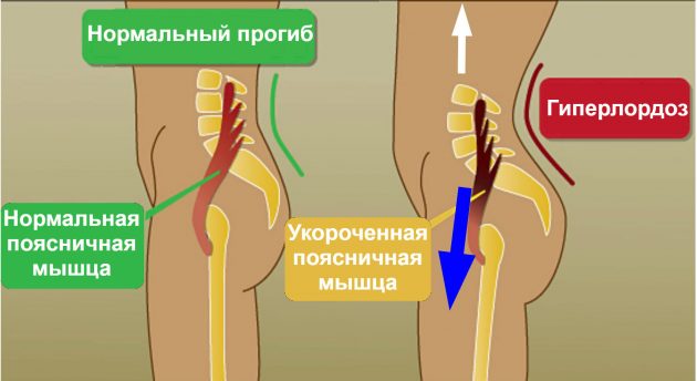 Как сесть на продольный шпагат и зачем это нужно Как сесть на продольный шпагат и зачем это нужно