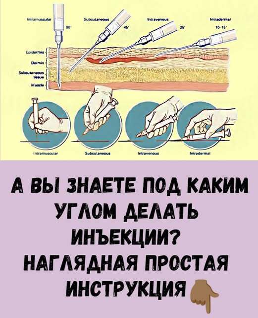 А вы знаете под каким углом делать инъекции? Наглядная простая инструкция! А вы знаете под каким углом делать инъекции? Наглядная простая инструкция!