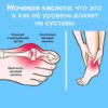 Мочевая кислота: что это и как её уровень влияет на суставы.