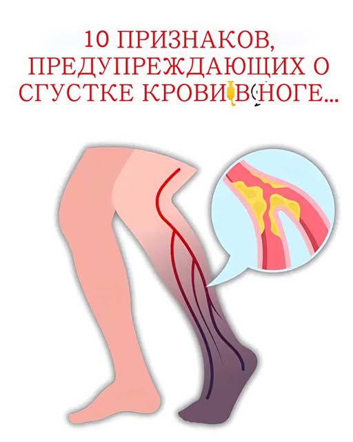 «Эти 9 симптомов на ногах могут спасти вам жизнь — не игнорируйте!». «Эти 9 симптомов на ногах могут спасти вам жизнь — не игнорируйте!».