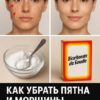 Как применять пищевую соду, чтобы убрать пятна, морщины и тёмные круги под глазами…