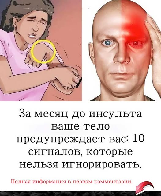 Врачи предупреждают: инсульт начинается за 30 дней, но мало кто это понимает Врачи предупреждают: инсульт начинается за 30 дней, но мало кто это понимает