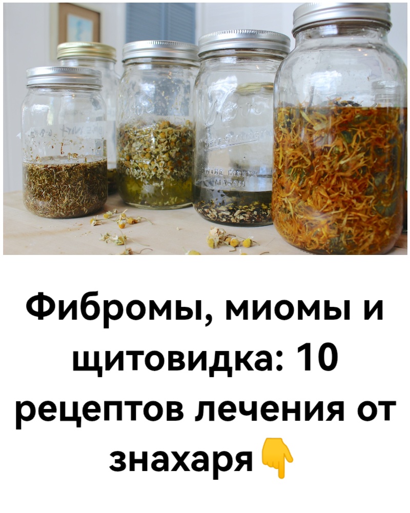Фибромы, миомы и щитовидка: 10 рецептов лечения от знахаря Фибромы, миомы и щитовидка: 10 рецептов лечения от знахаря