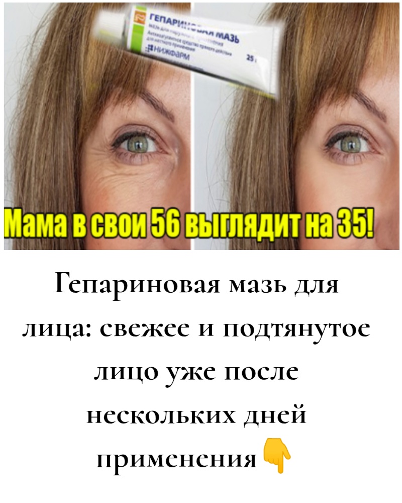 Гепариновая мазь для лица: свежее и подтянутое лицо уже после нескольких дней применения Гепариновая мазь для лица: свежее и подтянутое лицо уже после нескольких дней применения