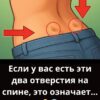 Если у вас есть эти два отверстия на спине, это означает…