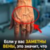 Видны ли ваши вены сквозь кожу? Ваше тело, возможно, пытается сказать вам ЭТО…