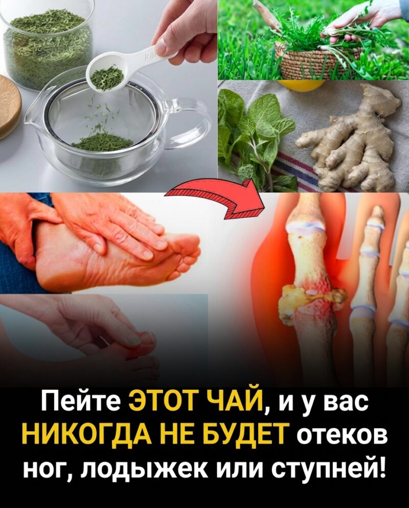 Выпейте этот чай, и у вас больше никогда не будет отеков ног, лодыжек или ступней! Выпейте этот чай, и у вас больше никогда не будет отеков ног, лодыжек или ступней!