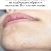 «Если ты женщина и у тебя растут волосы на подбородке — ты не одна. Вот что нужно знать».