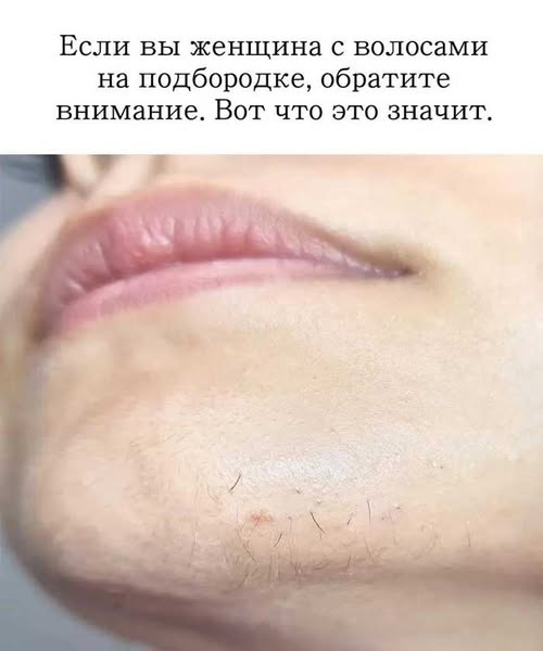 «Если ты женщина и у тебя растут волосы на подбородке — ты не одна. Вот что нужно знать».