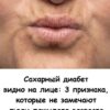 Сахарный диабет видно на лице: 3 признака, которые не замечают люди пожилого возраста