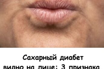 Сахарный диабет видно на лице: 3 признака, которые не замечают люди пожилого возраста