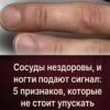 Состояние сосудов отражается на ногтях: 5 тревожных симптомов, на которые важно обратить внимание людям старше 55 лет.