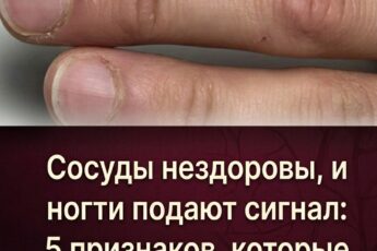 Состояние сосудов отражается на ногтях: 5 тревожных симптомов, на которые важно обратить внимание людям старше 55 лет.