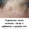 Старческие пятна ИСЧЕЗЛИ, когда я добавила в рацион эти 4 простых продукта.