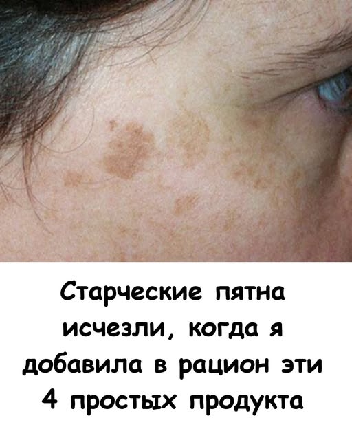 Старческие пятна ИСЧЕЗЛИ, когда я добавила в рацион эти 4 простых продукта. Старческие пятна ИСЧЕЗЛИ, когда я добавила в рацион эти 4 простых продукта.