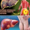 Узнайте 12 скрытых сигналов проблем с печенью. Симптомы, которые нельзя игнорировать, помогут вовремя защитить здоровье и сохранить жизнь.