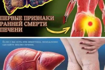 Узнайте 12 скрытых сигналов проблем с печенью. Симптомы, которые нельзя игнорировать, помогут вовремя защитить здоровье и сохранить жизнь.