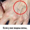 Если у вас видны вены, это означает, что вы...
