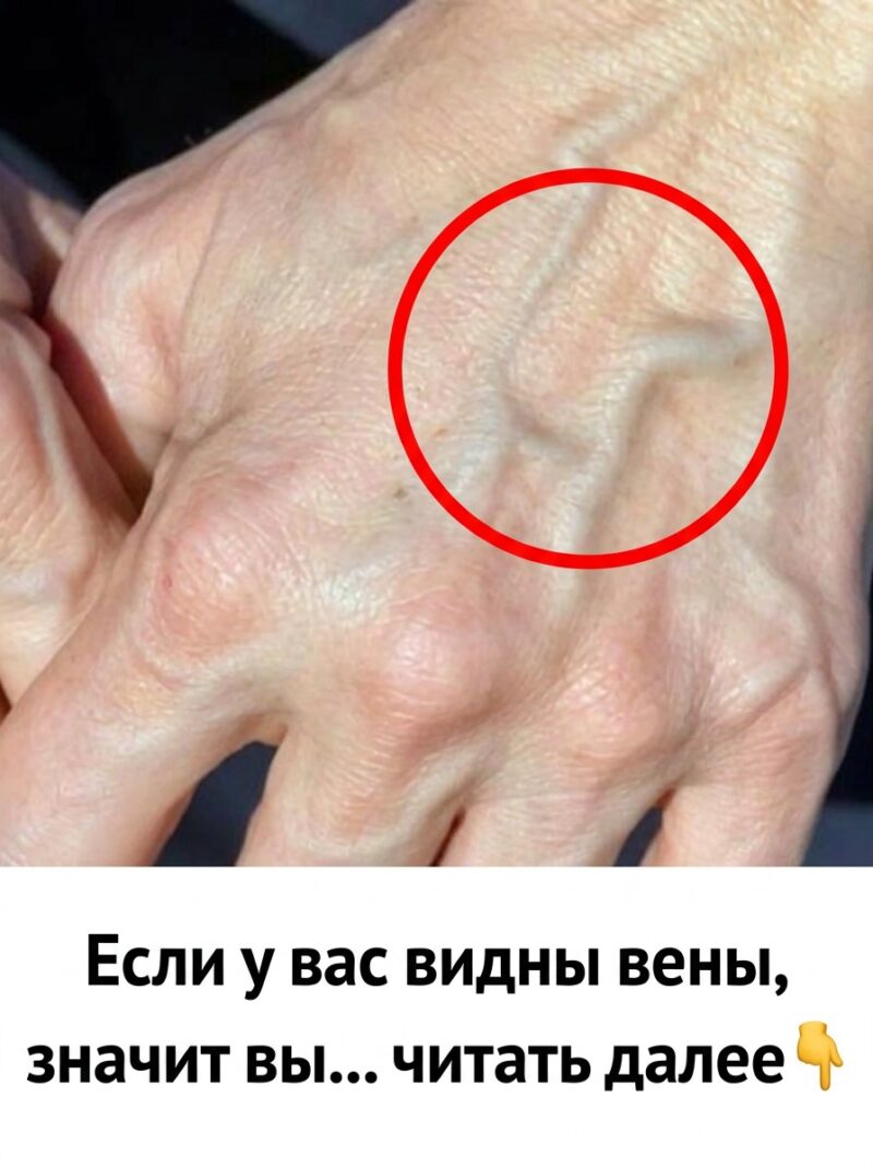 Если у вас видны вены, это означает, что вы... Если у вас видны вены, это означает, что вы...