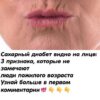 Прекратите кормить дuабет. Сахарный диабет видно на лице:17 признака, которые не замечают люди пожилого возраста