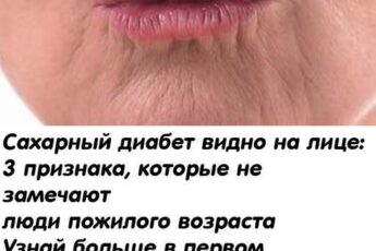 Прекратите кормить дuабет. Сахарный диабет видно на лице:17 признака, которые не замечают люди пожилого возраста