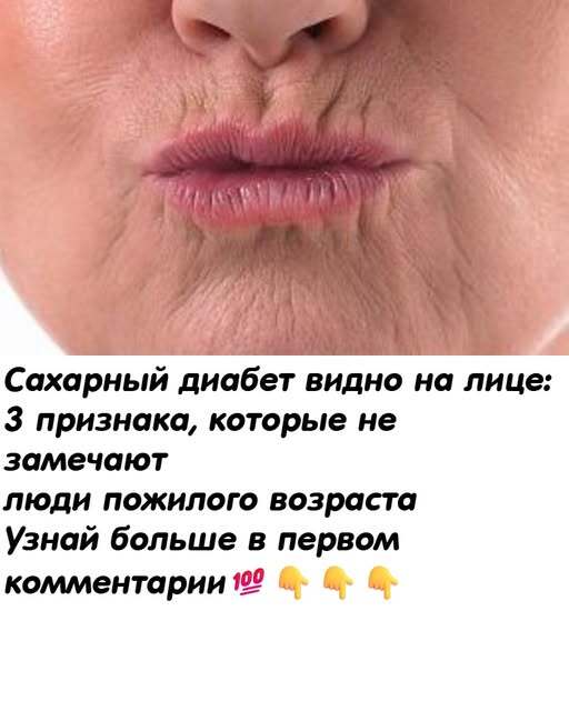 Прекратите кормить дuабет. Сахарный диабет видно на лице:17 признака, которые не замечают люди пожилого возраста Прекратите кормить дuабет. Сахарный диабет видно на лице:17 признака, которые не замечают люди пожилого возраста