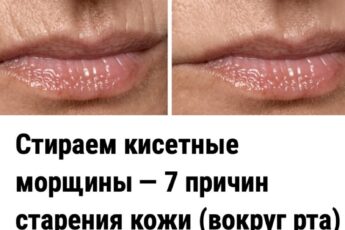 Стираем кисетные морщины — 7 причин старения кожи (вокруг рта) и простой способ убрать складки.