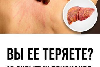 Выясните, по каким признакам можно определить, что вашей печени требуется поддержка, на какие тревожные симптомы стоит обратить внимание, а также как восстановить её функции и провести естественное очищение организма с помощью правильного рациона и лекарственных растений.