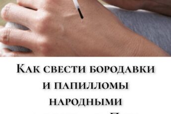 Как свести бородавки и папилломы народными средствами