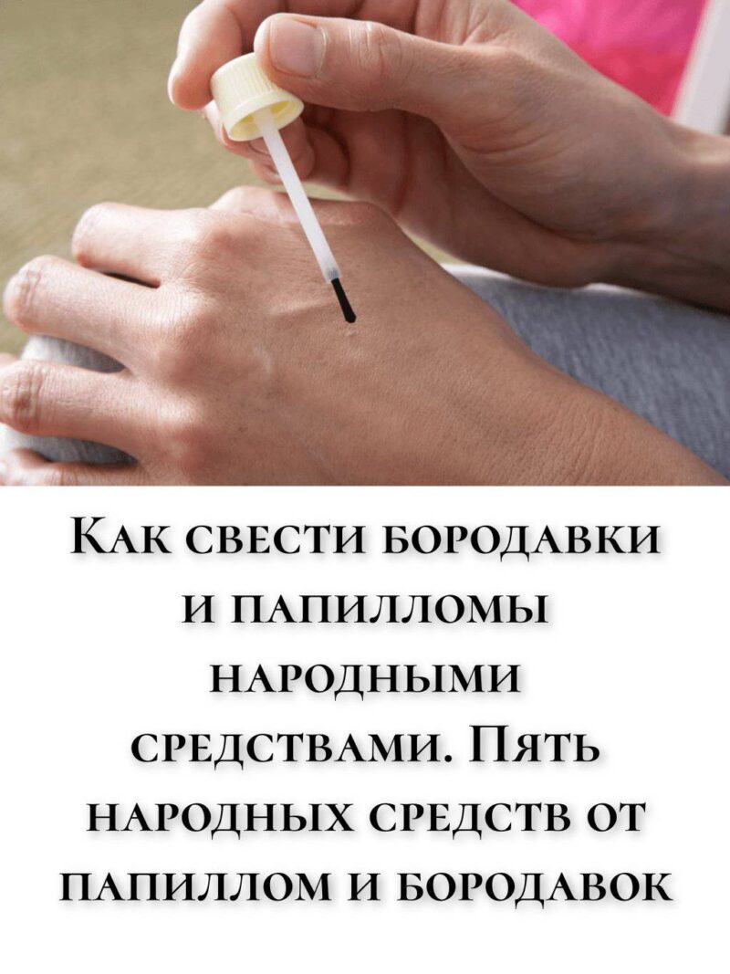 Как свести бородавки и папилломы народными средствами