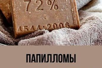Как удалить папилломы хозяйственным мылом