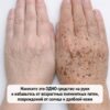Нанесите это единственное средство на руки, чтобы избавиться от пигментных пятен, последствий солнечного воздействия и дряблой кожи.