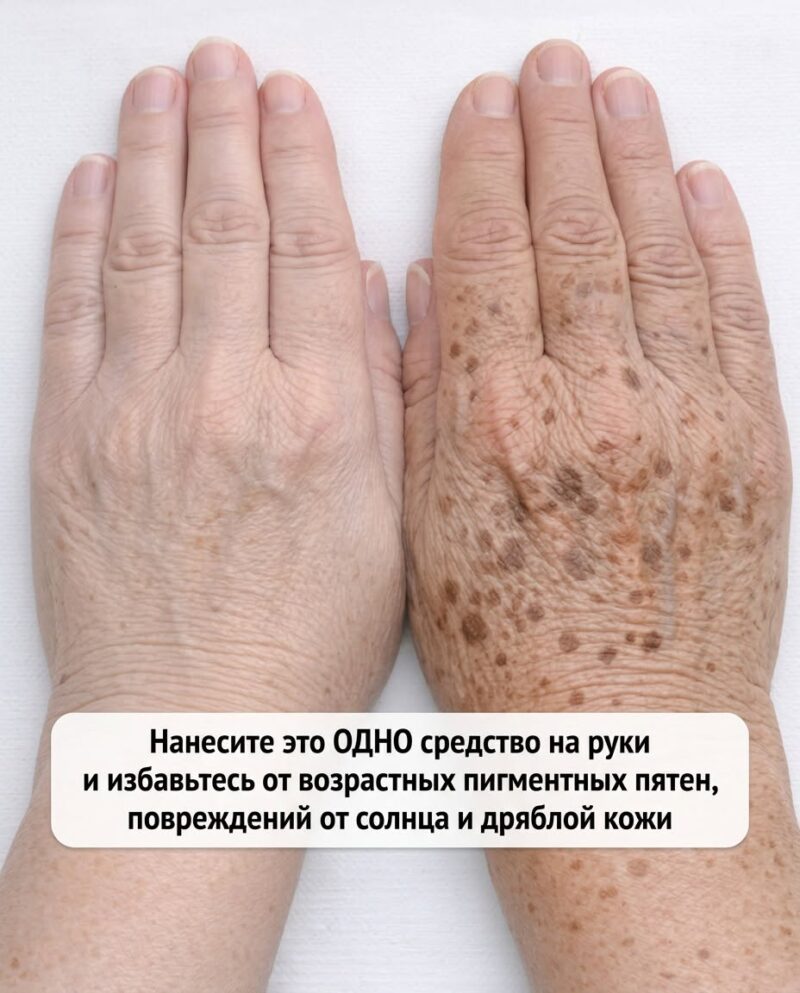 Нанесите это единственное средство на руки, чтобы избавиться от пигментных пятен, последствий солнечного воздействия и дряблой кожи.