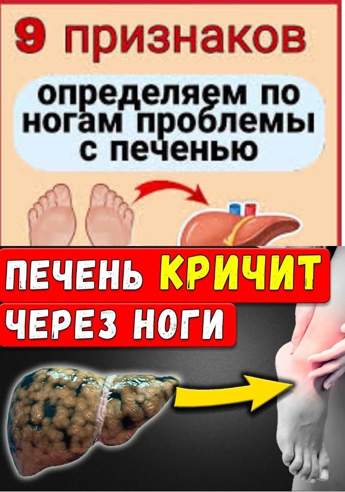 Ноги кричат SOS: 9 тревожных сигналов от вашей печени. 