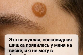 Симптомы и риски появления подозрительных новообразований на коже