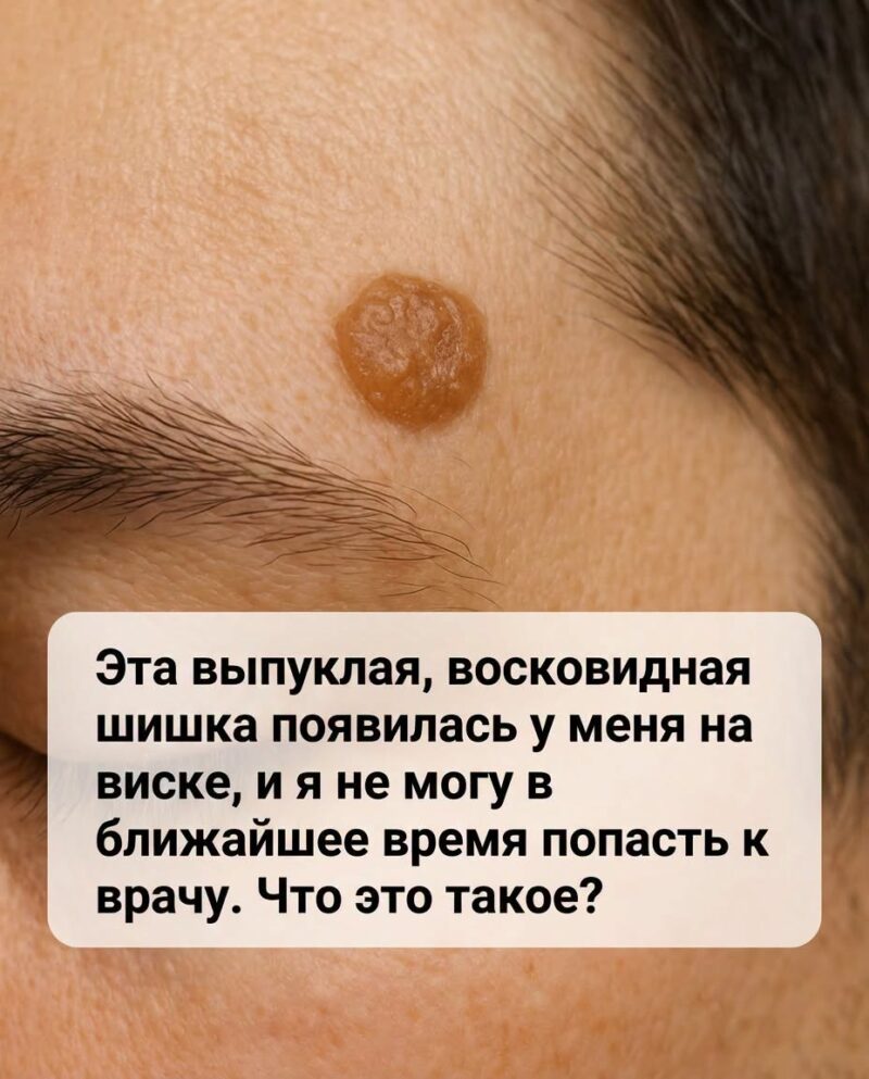 Симптомы и риски появления подозрительных новообразований на коже Симптомы и риски появления подозрительных новообразований на коже