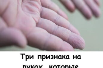 3 признака на руках, которые указывают на жировую болезнь печени