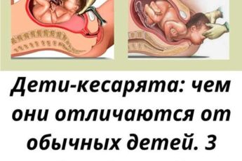 Дети-кесарята: чем они отличаются от обычных детей. 3 мифа и 2 правды о необычных малышах.