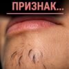 Волосы на подбородке женщины - признак...