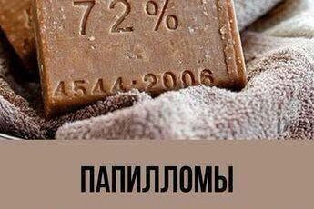 Как удалить папилломы хозяйственным мылом