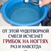 Применяя это средство от грибка на ногах , ты полностью вылечишь заболевание даже без аптечных препаратов!