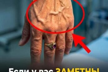 Видны ли ваши вены сквозь кожу? Ваше тело, возможно, пытается сказать вам ЭТО…