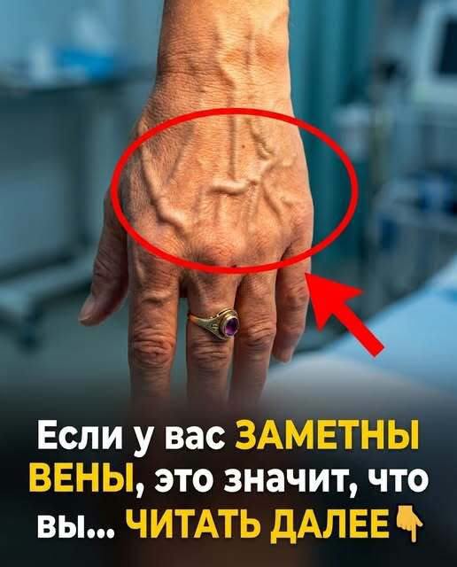 Видны ли ваши вены сквозь кожу? Ваше тело, возможно, пытается сказать вам ЭТО… Видны ли ваши вены сквозь кожу? Ваше тело, возможно, пытается сказать вам ЭТО…